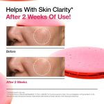 سرم ضد لک نیاسینامید 10% + ترانگزامیک اسید 4% آنوا - تصویر 2